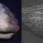 HyperCam-fist-images