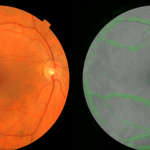 Google-AI-hartproblemen