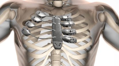 human radiography scan  with bones