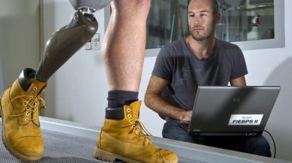 _74233456_prosthetic