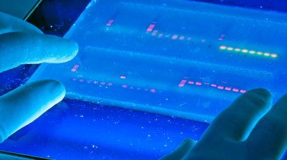 Agarose_gel_with_UV_illumination_-_Ethidium_bromide_stained_DNA_glows_orange_(close-up)