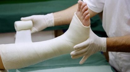 Broken_leg