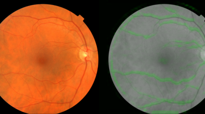 Google-AI-hartproblemen