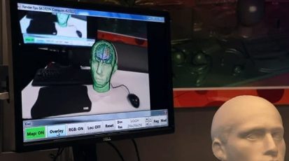 kinect_brain_scan